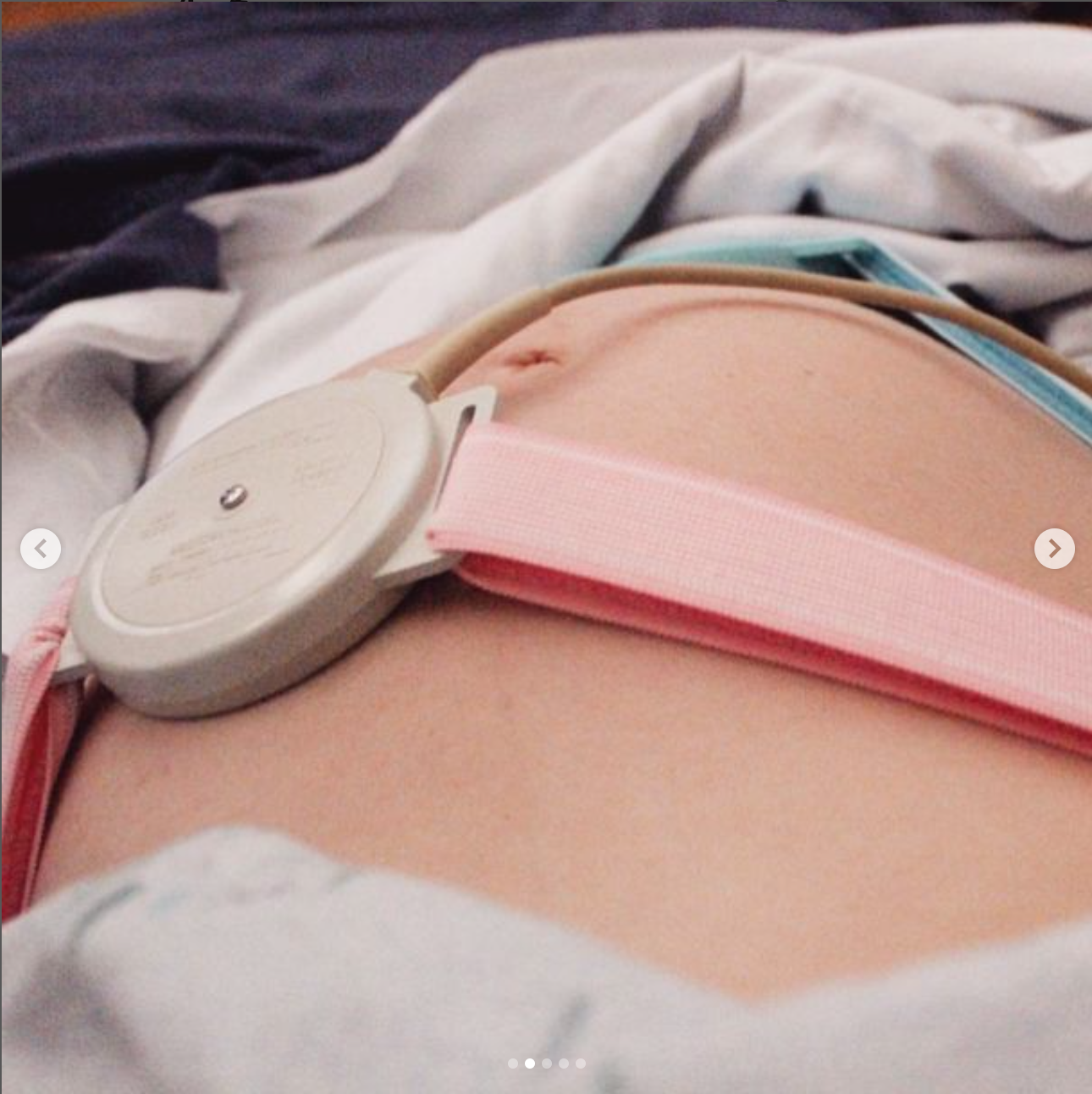 Pregnant stomach with fetal heart rate monitor getting ready for birth